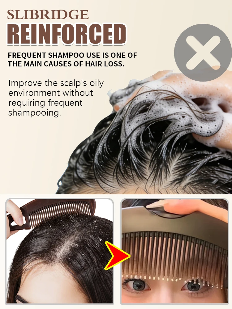 Dandruff removal Combs scalp massage comb hair volumizing Hot selling in 2026,free shipping,Unisex - Image 4